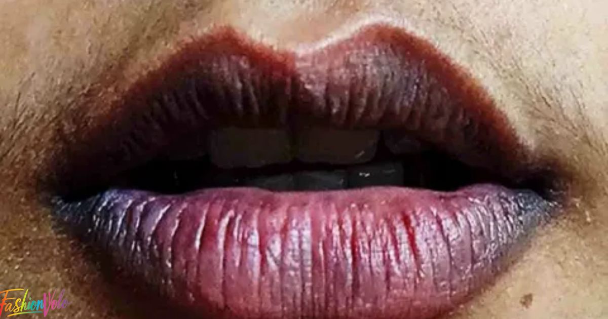 What are dark lips?