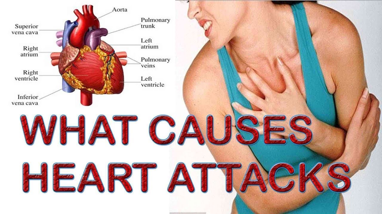 Causes and Risk Factors